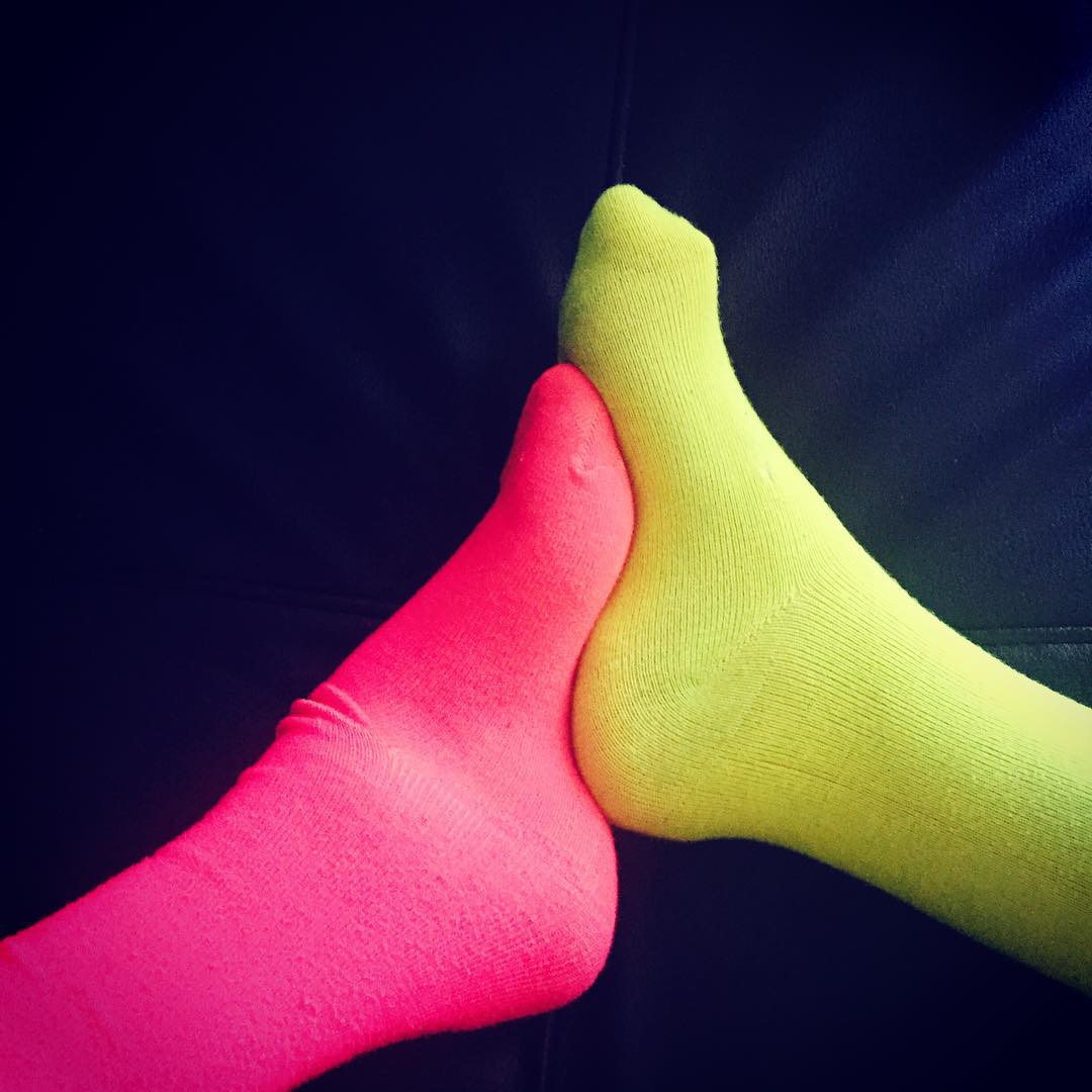Two high-arched club feet in neon socks, one pink and one yellow, interlock.