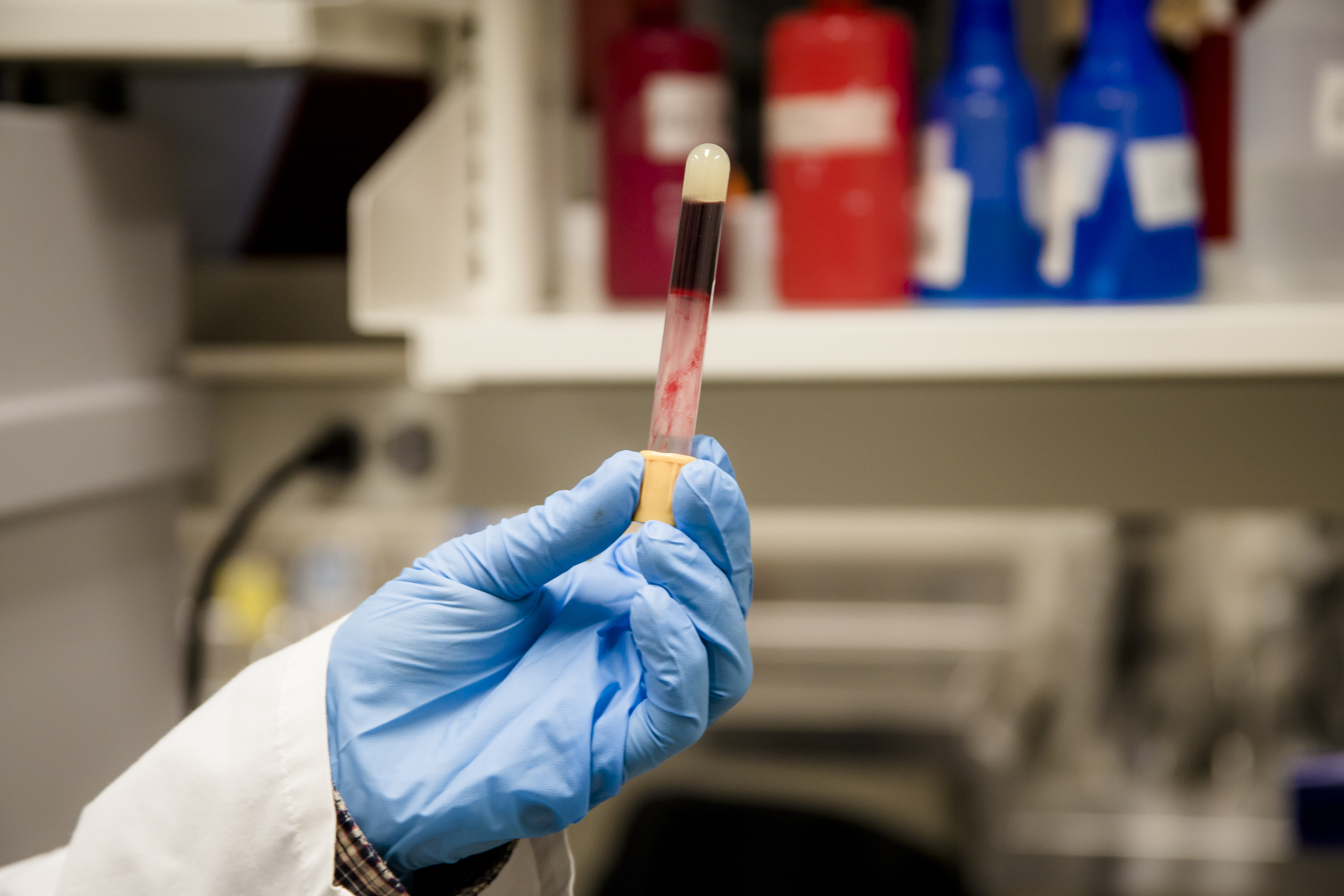 A sample of my blood. Photo credit: Jimmy Limit. Test tube filled with blood